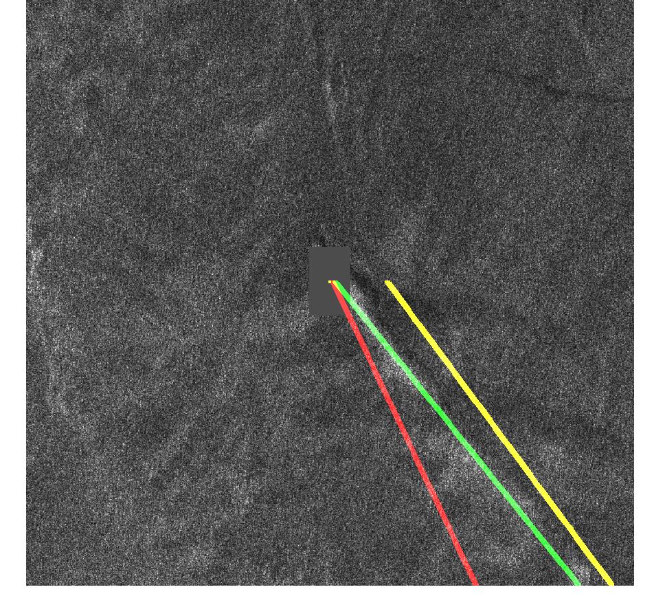 Figure 33